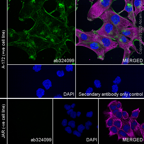 Immunocytochemistry/ Immunofluorescence - Goat Anti-Rabbit IgG H&L (Alexa Fluor® 488) preadsorbed (ab150081), expandable thumbnail