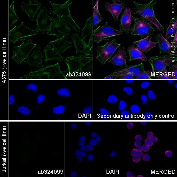 Immunocytochemistry/ Immunofluorescence - Goat Anti-Rabbit IgG H&L (Alexa Fluor® 488) preadsorbed (ab150081), expandable thumbnail