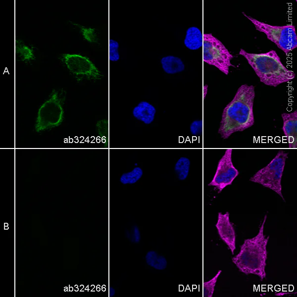 Immunocytochemistry/ Immunofluorescence - Goat Anti-Rabbit IgG H&L (Alexa Fluor® 488) preadsorbed (AB150081)