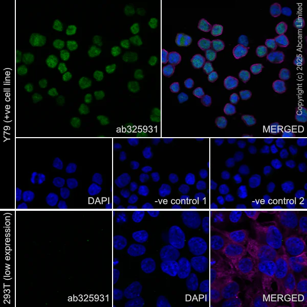 Immunocytochemistry/ Immunofluorescence - Goat Anti-Rabbit IgG H&L (Alexa Fluor® 488) preadsorbed (AB150081)