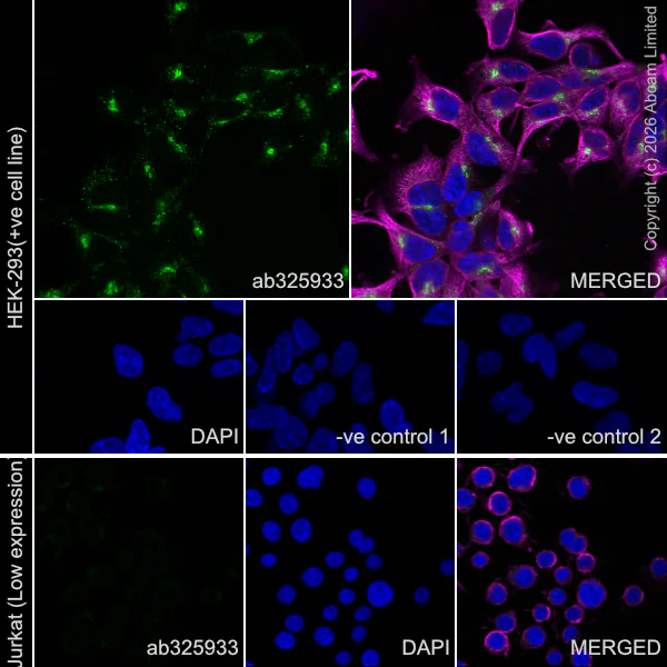 Immunocytochemistry/ Immunofluorescence - Goat Anti-Rabbit IgG H&L (Alexa Fluor® 488) preadsorbed (AB150081)