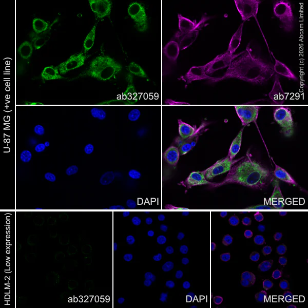 Immunocytochemistry/ Immunofluorescence - Goat Anti-Rabbit IgG H&L (Alexa Fluor® 488) preadsorbed (AB150081)