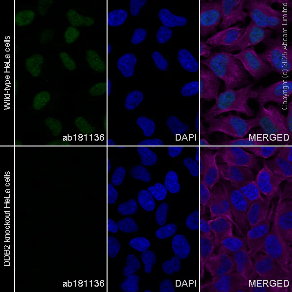 Immunocytochemistry/ Immunofluorescence - Goat Anti-Rabbit IgG H&L (Alexa Fluor® 488) preadsorbed (AB150081)
