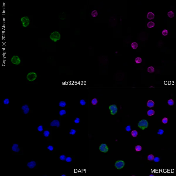 Immunocytochemistry/ Immunofluorescence - Goat Anti-Rabbit IgG H&L (Alexa Fluor® 488) preadsorbed (AB150081)