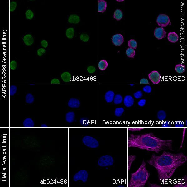 Immunocytochemistry/ Immunofluorescence - Goat Anti-Rabbit IgG H&L (Alexa Fluor® 488) preadsorbed (AB150081)
