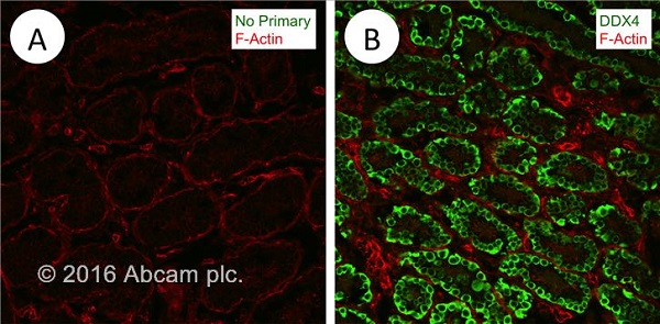 Immunohistochemistry (Frozen sections) - Goat Anti-Rabbit IgG H&L (Alexa Fluor® 488) preadsorbed (ab150081), expandable thumbnail