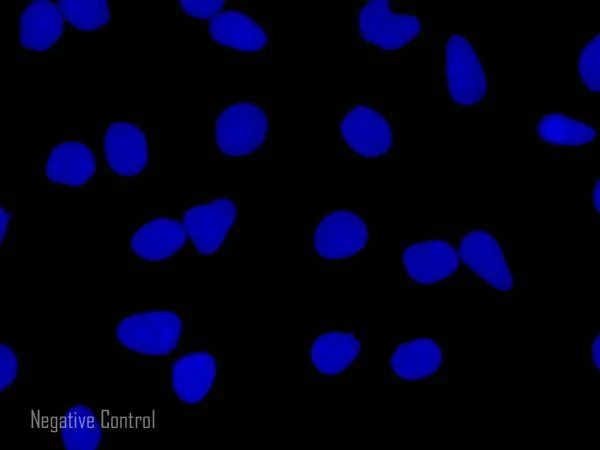 Immunocytochemistry/ Immunofluorescence - Goat Anti-Rabbit IgG H&L (Alexa Fluor® 555) (AB150078)