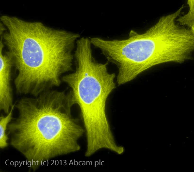 Immunocytochemistry/ Immunofluorescence - Goat Anti-Rabbit IgG H&L (Alexa Fluor® 555) (AB150078)