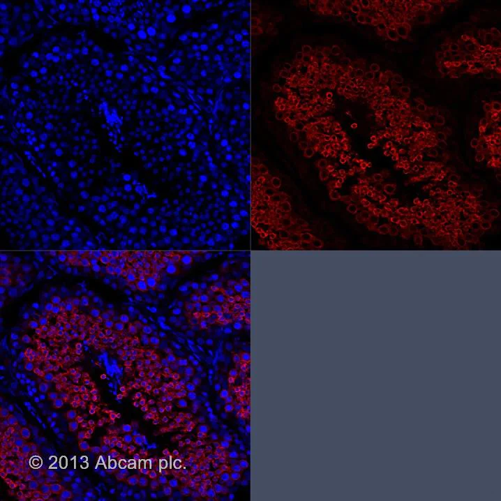 Goat anti-rabbit IgG (Alexa Fluor® 555) secondary antibody