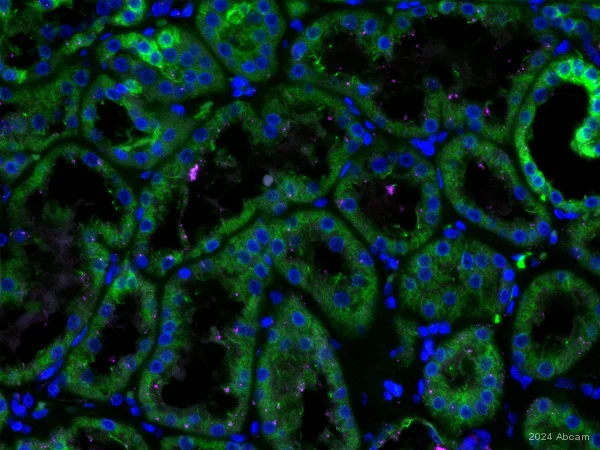 Immunohistochemistry (Formalin/PFA-fixed paraffin-embedded sections) - Goat Anti-Rabbit IgG H&L (Alexa Fluor® 555) (AB150078)