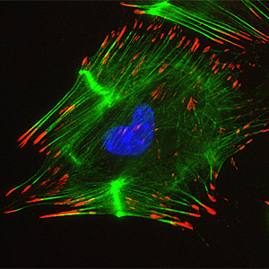 Immunocytochemistry/ Immunofluorescence - Goat Anti-Rabbit IgG H&L (Alexa Fluor® 555) preadsorbed (AB150082), expandable thumbnail