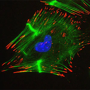 Immunocytochemistry/ Immunofluorescence - Goat Anti-Rabbit IgG H&L (Alexa Fluor® 555) preadsorbed (AB150082)
