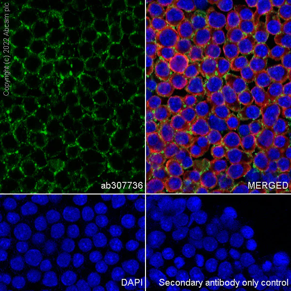 Immunocytochemistry/ Immunofluorescence - Goat Anti-Rabbit IgG H&L (Alexa Fluor® 555) preadsorbed (AB150082)