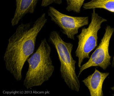 Goat Anti Rabbit (IgG) secondary antibody preadsorbed Alexa