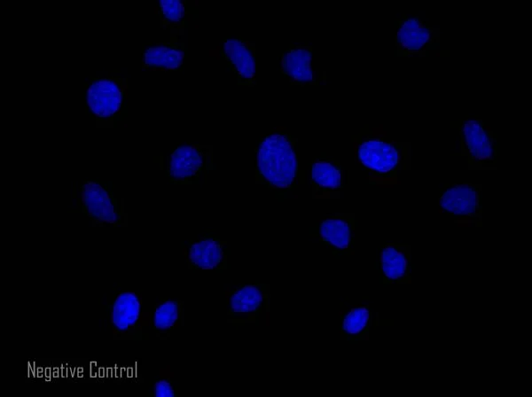 Goat Anti Rabbit (IgG) secondary antibody preadsorbed Alexa