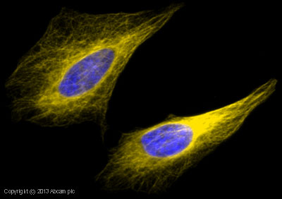 Immunocytochemistry/ Immunofluorescence - Goat Anti-Rabbit IgG H&L (Alexa Fluor® 568) preadsorbed (AB175696), expandable thumbnail