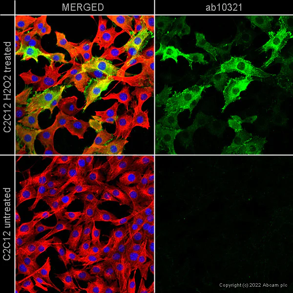 Immunocytochemistry/ Immunofluorescence - Goat Anti-Rabbit IgG H&L (Alexa Fluor® 594) (AB150080)