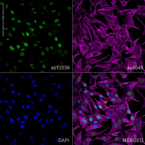 Immunocytochemistry/ Immunofluorescence - Goat Anti-Rabbit IgG H&L (Alexa Fluor® 594) (AB150080)