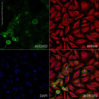 Immunocytochemistry/ Immunofluorescence - Goat Anti-Rabbit IgG H&L (Alexa Fluor® 594) (AB150080)
