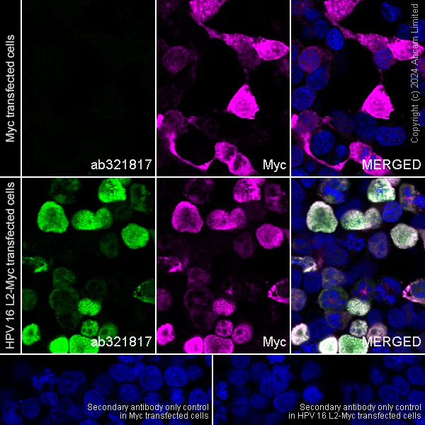 Immunocytochemistry/ Immunofluorescence - Goat Anti-Rabbit IgG H&L (Alexa Fluor® 594) (AB150080)