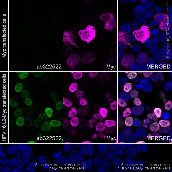 Immunocytochemistry/ Immunofluorescence - Goat Anti-Rabbit IgG H&L (Alexa Fluor® 594) (AB150080)