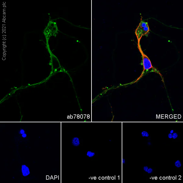 Immunocytochemistry/ Immunofluorescence - Goat Anti-Rabbit IgG H&L (Alexa Fluor® 594) (AB150080)