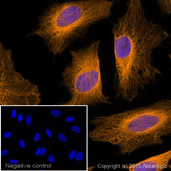 Goat anti-rabbit IgG (Alexa Fluor® 594) secondary antibody