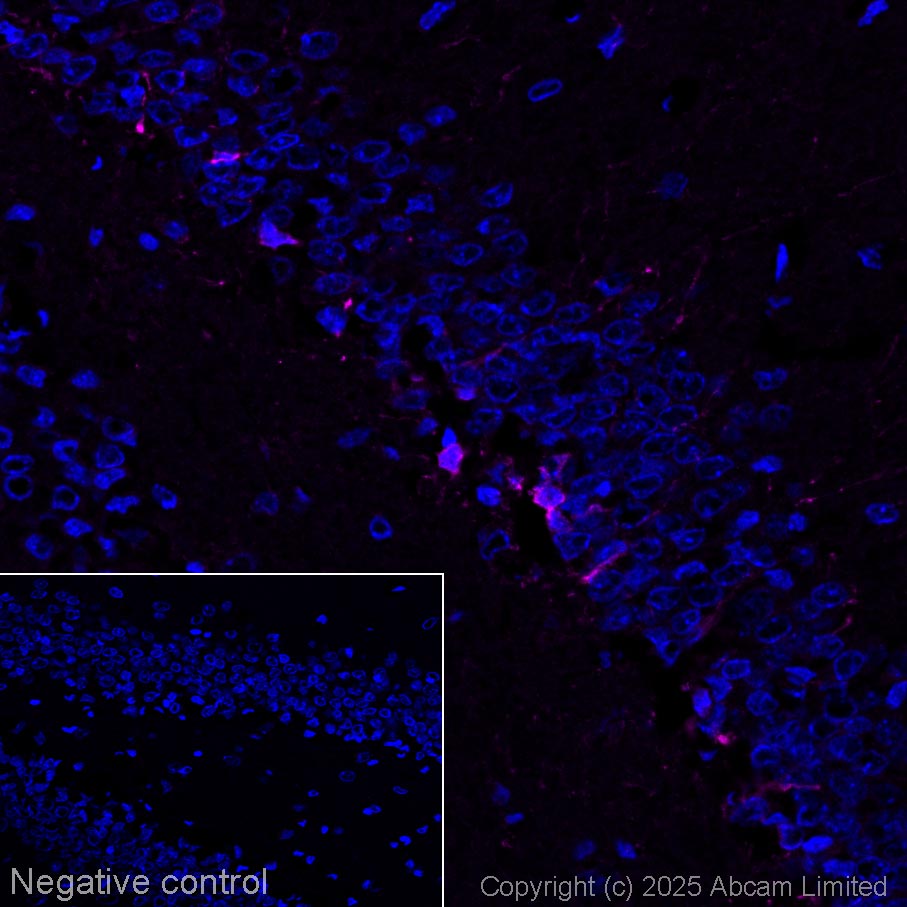 Immunohistochemistry (Frozen sections) - Goat Anti-Rabbit IgG H&L (Alexa Fluor® 594) (ab150080), expandable thumbnail