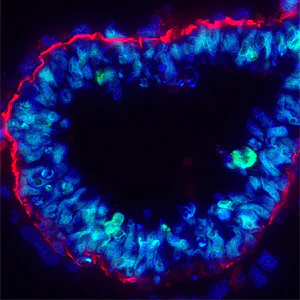 Goat Anti-Rabbit IgG (Alexa Fluor® 594) preadsorbed secondary