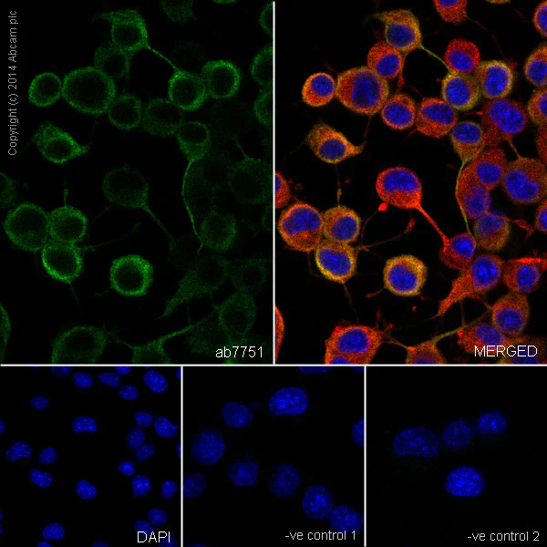 Immunocytochemistry/ Immunofluorescence - Goat Anti-Rabbit IgG H&L (Alexa Fluor® 594) preadsorbed (AB150088)