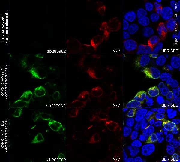 Immunocytochemistry/ Immunofluorescence - Goat Anti-Rabbit IgG H&L (Alexa Fluor® 594) preadsorbed (AB150088)