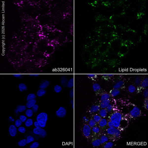 Immunocytochemistry/ Immunofluorescence - Goat Anti-Rabbit IgG H&L (Alexa Fluor® 594) preadsorbed (AB150088)