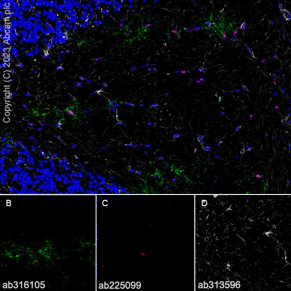 Immunohistochemistry (Frozen sections) - Goat Anti-Rabbit IgG H&L (Alexa Fluor® 594) preadsorbed (AB150088)