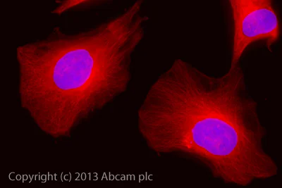 Anitaページ Goat anti-rabbit IgG (Alexa Fluor® 488) secondary antibody