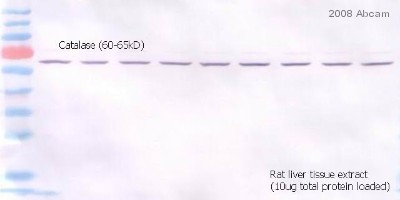 Western blot - Goat Anti-Rabbit IgG H&L (Alkaline Phosphatase) (AB6722), expandable thumbnail