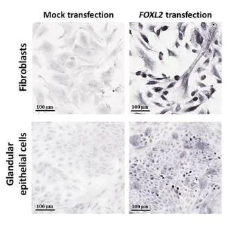 Immunocytochemistry/ Immunofluorescence - Goat Anti-Rabbit IgG H&L (Biotin) (AB6720)