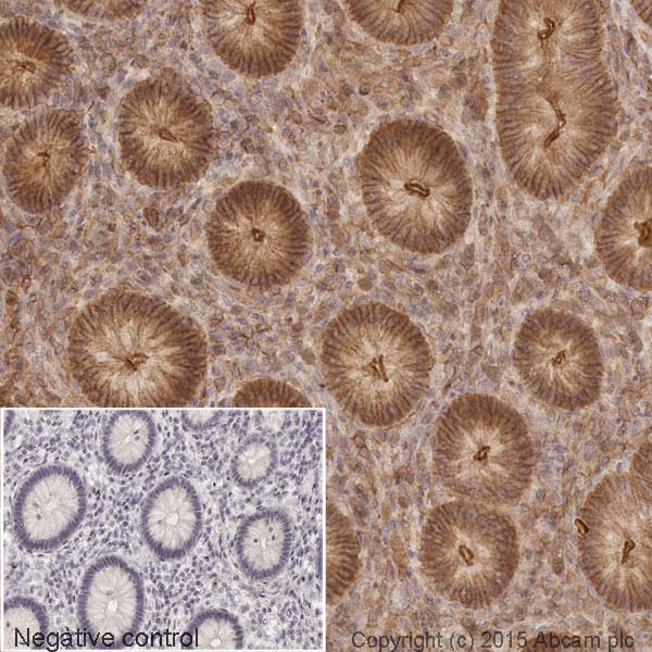Immunohistochemistry (Formalin/PFA-fixed paraffin-embedded sections) - Goat Anti-Rabbit IgG H&L (Biotin) (AB6720)