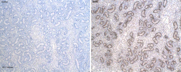 Immunohistochemistry (Formalin/PFA-fixed paraffin-embedded sections) - Goat Anti-Rabbit IgG H&L (Biotin) (AB97049)