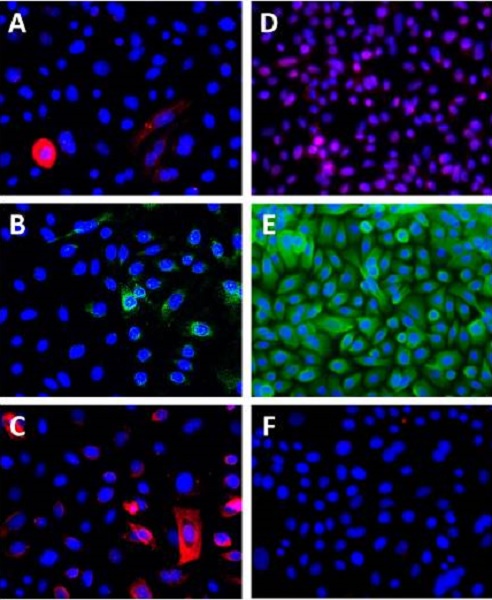 Immunocytochemistry/ Immunofluorescence - Goat Anti-Rabbit IgG H&L (Cy3 ®) preadsorbed (AB6939), expandable thumbnail