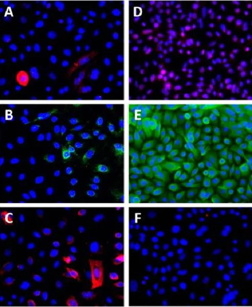 Immunocytochemistry/ Immunofluorescence - Goat Anti-Rabbit IgG H&L (Cy3 ®) preadsorbed (AB6939)