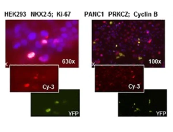 Immunocytochemistry/ Immunofluorescence - Goat Anti-Rabbit IgG H&L (Cy3 ®) preadsorbed (AB6939)