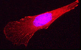 Immunocytochemistry/ Immunofluorescence - Goat Anti-Rabbit IgG H&L (Cy3 ®) preadsorbed (AB97075)