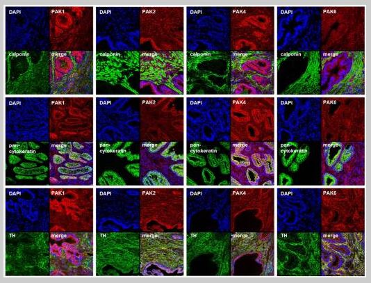 Immunohistochemistry (Frozen sections) - Goat Anti-Rabbit IgG H&L (Cy5 ®) preadsorbed (AB6564), expandable thumbnail