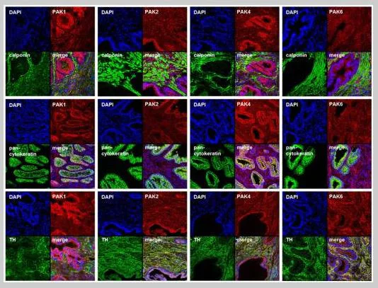Immunohistochemistry (Frozen sections) - Goat Anti-Rabbit IgG H&L (Cy5 ®) preadsorbed (AB6564)