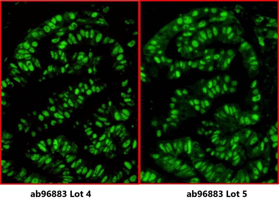 Immunohistochemistry (Formalin/PFA-fixed paraffin-embedded sections) - Goat Anti-Rabbit IgG H&L (DyLight® 488) (AB96883)