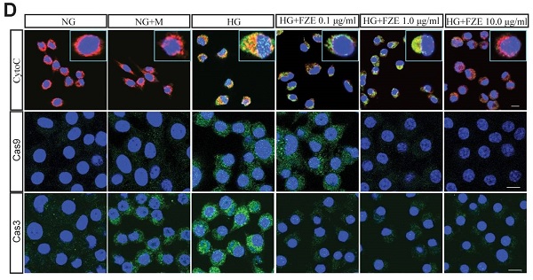 Immunocytochemistry/ Immunofluorescence - Goat Anti-Rabbit IgG H&L (DyLight® 488) preadsorbed (AB96899), expandable thumbnail