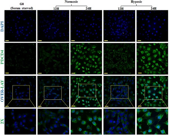 Immunocytochemistry/ Immunofluorescence - Goat Anti-Rabbit IgG H&L (FITC) (AB6717), expandable thumbnail