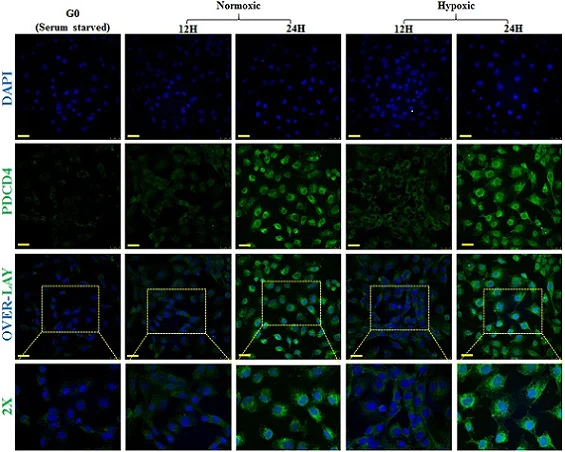 Immunocytochemistry/ Immunofluorescence - Goat Anti-Rabbit IgG H&L (FITC) (AB6717)