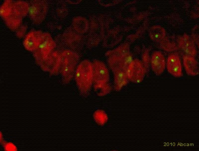 Immunohistochemistry (Formalin/PFA-fixed paraffin-embedded sections) - Goat Anti-Rabbit IgG H&L (FITC) (AB6717)