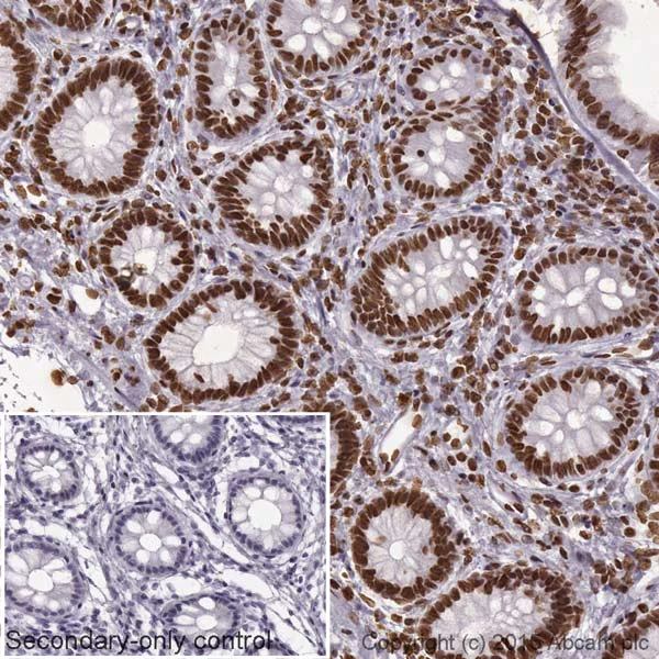 Immunohistochemistry (Formalin/PFA-fixed paraffin-embedded sections) - Goat Anti-Rabbit IgG H&L (HRP) (AB205718)